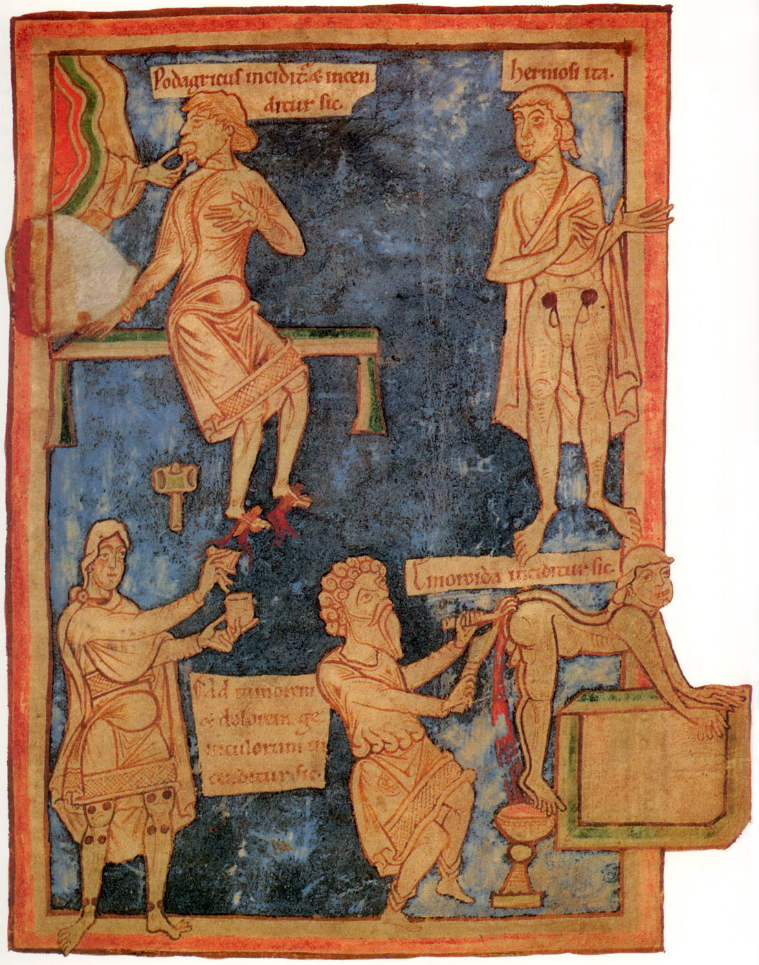 11th_century_English_surgery.jpg