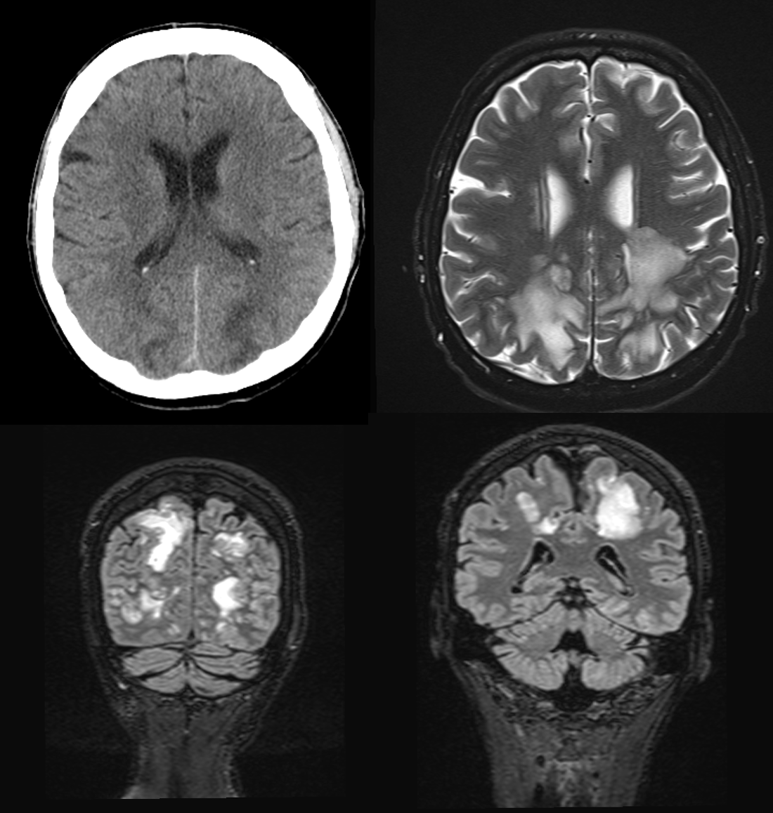 Medical Case - Aymen - Hypertensive Crisis Nicotine.png